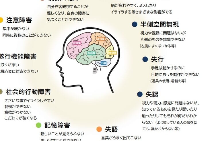 高知能者の特徴、その脳と日常生活 1 e9ab98e79fa5e883bde88085e381aee789b9e5beb4e38081e3819de381aee884b3e381a8e697a5e5b8b8e7949fe6b4bb